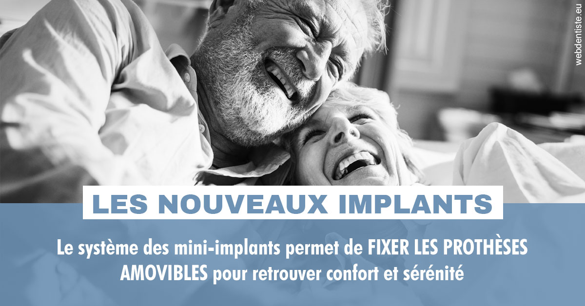 https://selarl-drsboutin.chirurgiens-dentistes.fr/Les nouveaux implants 2