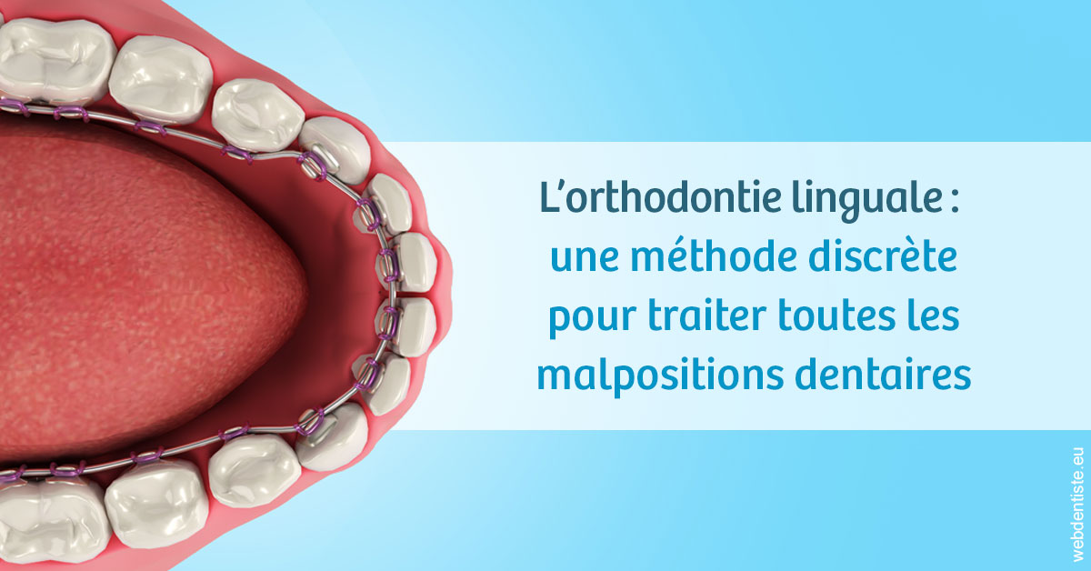 https://selarl-drsboutin.chirurgiens-dentistes.fr/L'orthodontie linguale 1