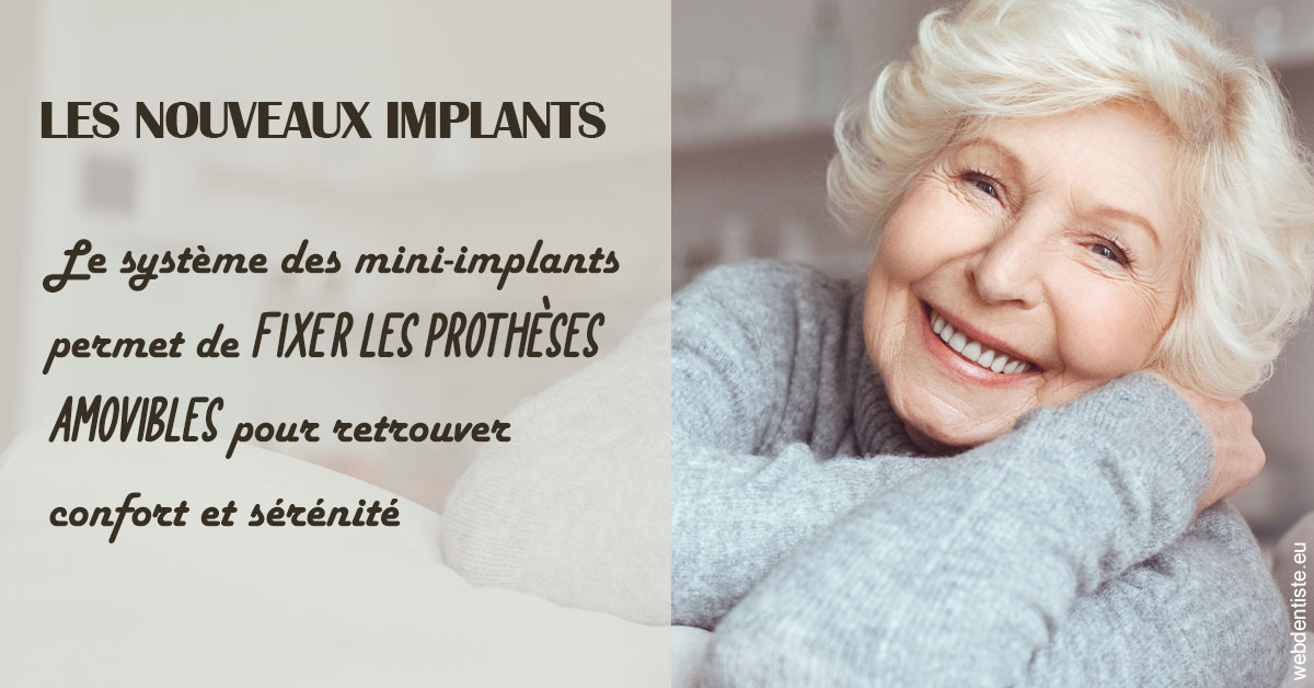 https://selarl-drsboutin.chirurgiens-dentistes.fr/Les nouveaux implants 1