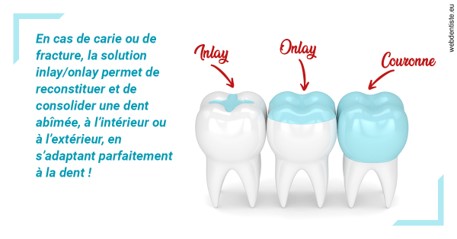 https://selarl-drsboutin.chirurgiens-dentistes.fr/L'INLAY ou l'ONLAY