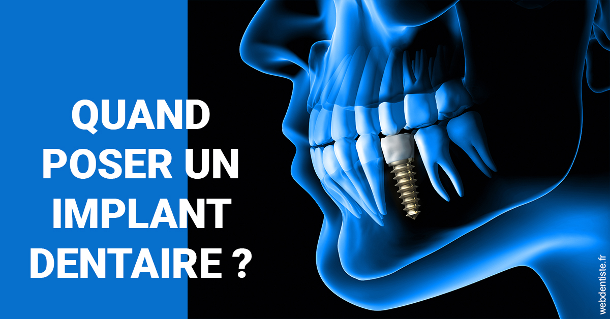 https://selarl-drsboutin.chirurgiens-dentistes.fr/Les implants 1
