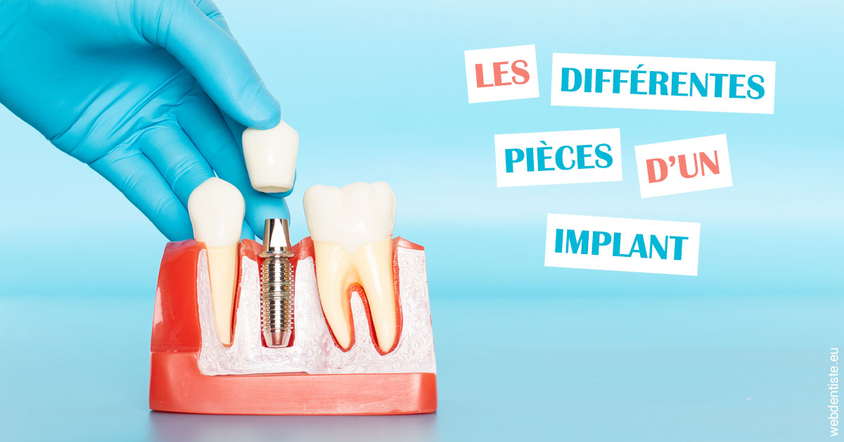 https://selarl-drsboutin.chirurgiens-dentistes.fr/Les différentes pièces d’un implant 2