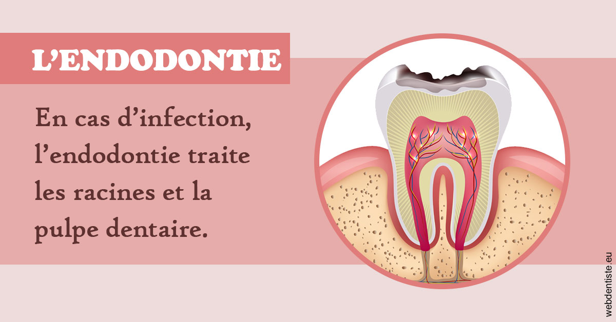 https://selarl-drsboutin.chirurgiens-dentistes.fr/L'endodontie 2